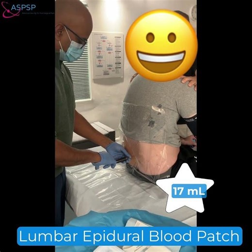 Epidural Blood Patch for Traumatic CSF Leak