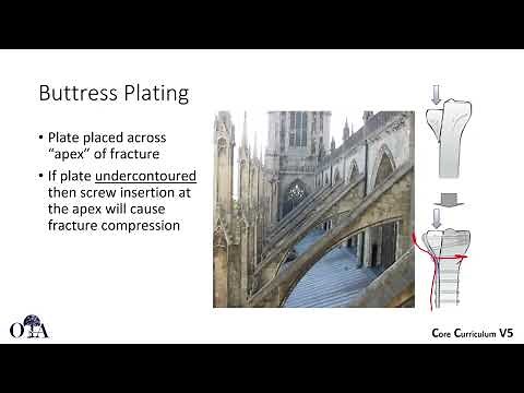 Basic principles of internal fixation - 2 of 2