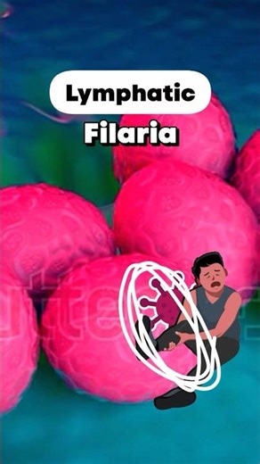 Treatment Of Elephantiasis 🐘 #shorts