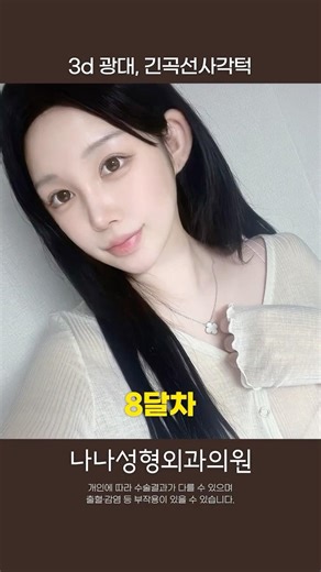 얼굴 여백의 중요성 #험티덤티