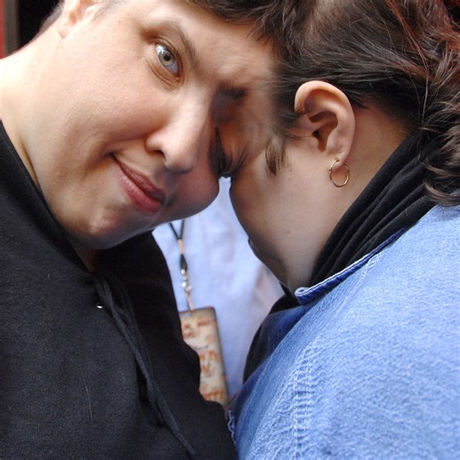 World's Oldest Conjoined Twins Lori and George Schappell Dead at 62
