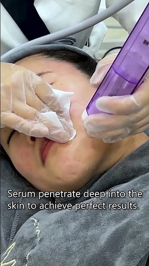 Oxygen Jet Peel – No Needles, Just Results! #beautymachinefactory