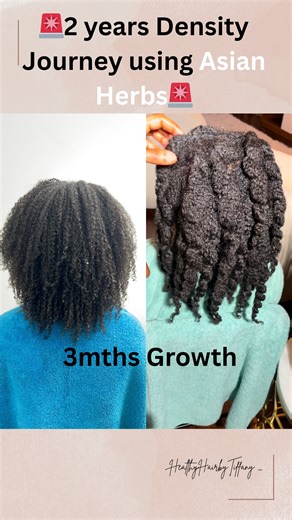 Hair Density Surgeon | Scalp Expert | Holistic Hair Educator on Instagram: "Save this. Share it. Tag friends and family who need hope for a sparse scalp. Healing is still possible. Low density hair is usually a signal, not a failure. A signal of imbalance. A signal of inflammation. A signal that key nutrients are missing. True hair care should do more than coat strands. It should calm a dry, irritated scalp, strengthen root anchoring, and support fuller, thicker growth from the follicle up. When