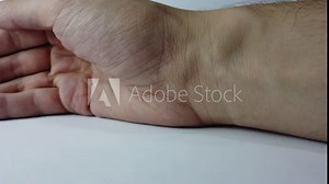 Close-up of man's wrist showing pulsating veins in multiple spots.