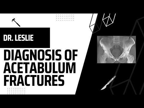 Diagnosis of Acetabulum Fractures w/ Dr. Leslie