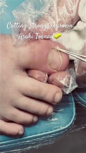 The Ultimate Guide to Fix Toenail Regrowth!