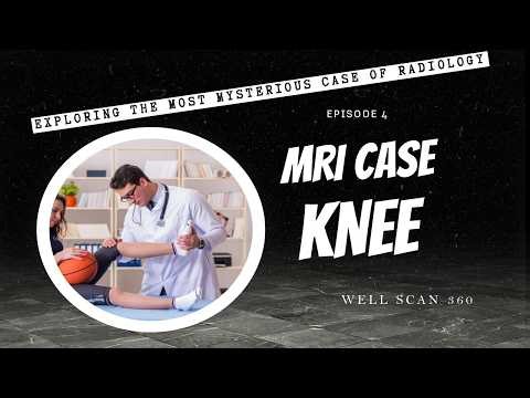 Knee MRI Anatomy and Pathology Explained | Medical Imaging | Radiology Made Simple | Well Scan360