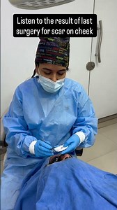 Scar removal on face | how to remove scar | best solution for scar removal #scarrevision #scarless