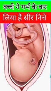 Baby Head Down Position During Pregnancy #normaldelivery #pregnancy #cephalicposition #Facebook | Raturi Mom baby care