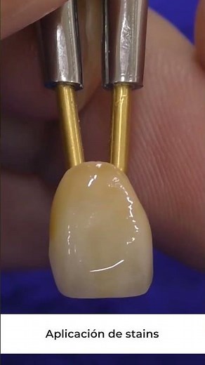 Tips Porcelana CZR Cerabien FC Paste Stain | Parte 4