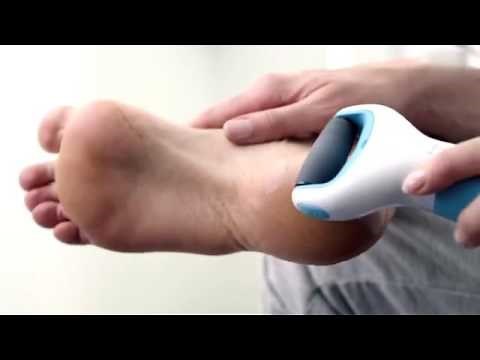 Cordless Electric Callus Remover