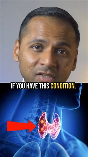 Stop Taking Ashwagandha If...(Thyroid Warning)
