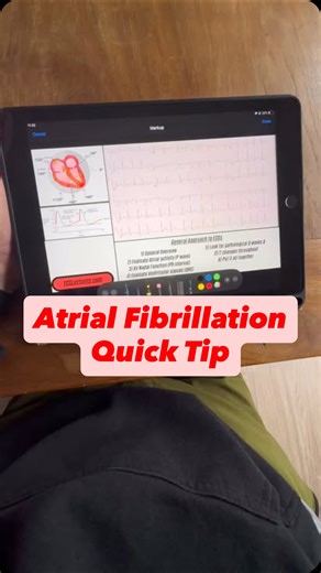 ECG Lectures with Reid on Instagram: "AV Nodal Conduction in AFib #ecg #ekg"