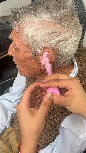 The process of creating a custom ear molds for a patient. 🦻