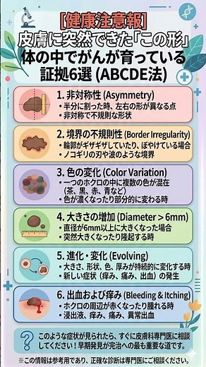 041 皮膚に突然できた「この形」体の中でがんが育っている証拠6選 ABCDE法