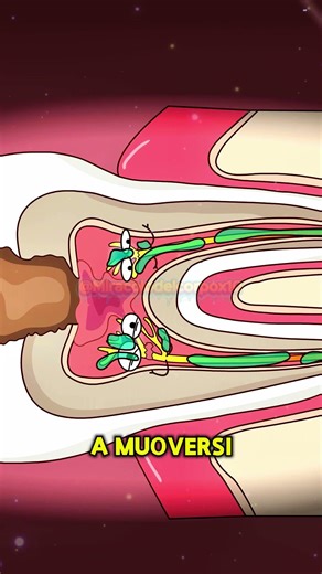 🦷Perché la pulpite è così dolorosa?❓#shorts#funny#hot