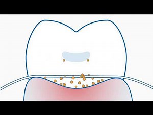 Curaprox Interdental Brushes vs Floss