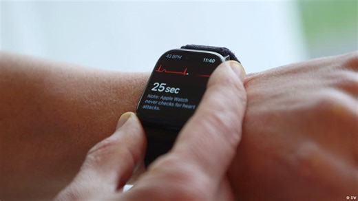 How reliable are ECG functions in smartwatches?