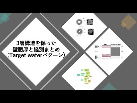 腹部CTにおける腸管の3層構造を保った壁肥厚と鑑別まとめ