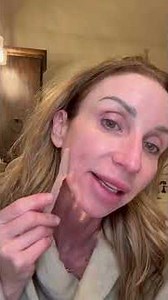 Check out my new dermaplaner!