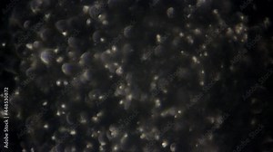 Microscopic view adjusts focus to reveal sperm cells.