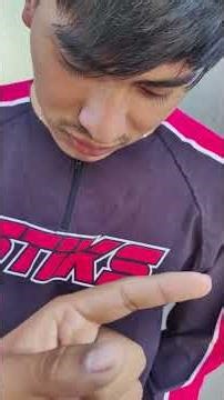 Control de epistaxis