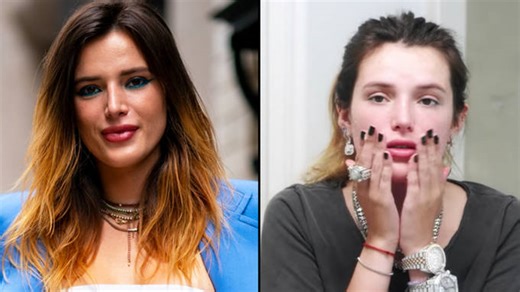 People are horrified by Bella Thorne's "natural" acne scar treatment