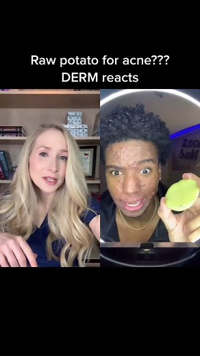 Potatoes for Acne Treatment: Dermatologist Reacts to DERM's Raw Potato Method