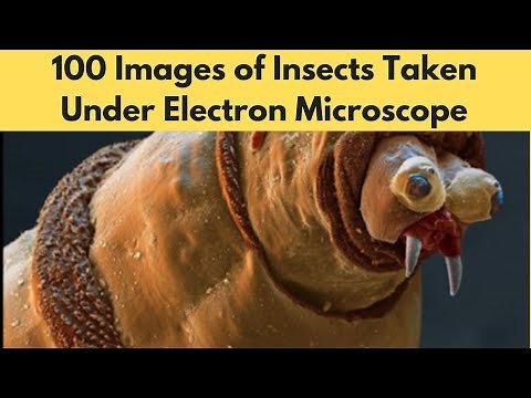 100 Images of Insects Taken Under Electron Microscope