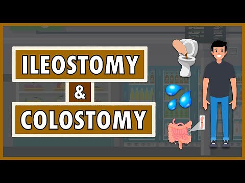 Ileostomy and Colostomy | Emphasis on Diet/Nutrition