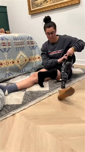 74 /100. Rotationplasty Surgery Explained | क्यों डॉक्टर पैर उल्टा जोड़ते हैं Life-Saving Hack