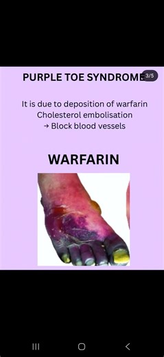 #warferin #effect #nursing notes #learning 👀📚