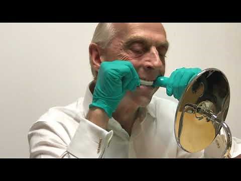 Fitting a Tomed SomnoGuard SPX Mandibular Advancement Device