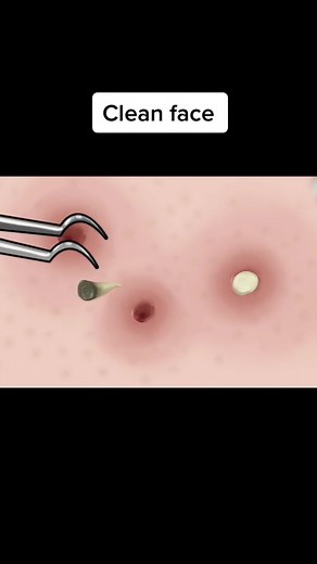 ASMR Cleaning Animation: Clean Face Story