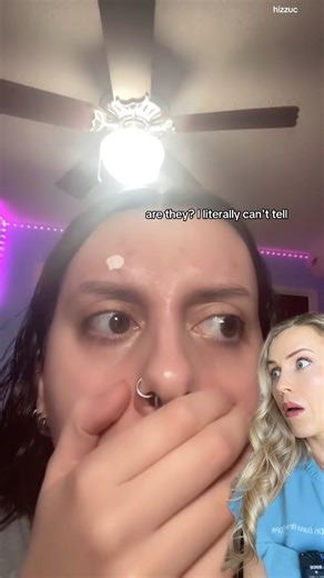 Doctor reacts: transparent eyelids?!