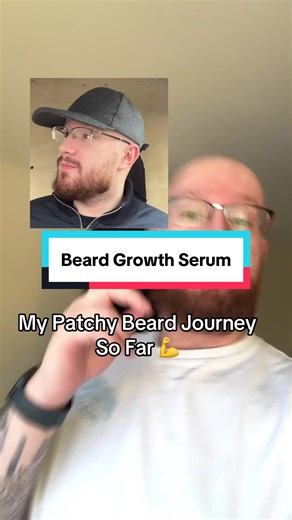 Effective Beard Growth Tips for Patchy Beards