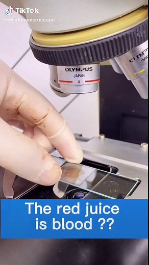 Wisdom microscope on TikTok