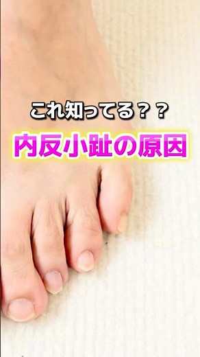 【内反小趾】を解消する！今すぐできる簡単セルフケア！｜埼玉県北本市－はやと整体 #内反小趾 #足の痛み #足の疲れ