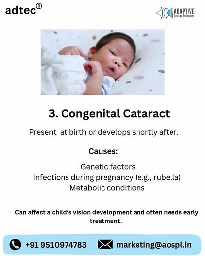 Types of Cataracts Explained | Age-Related, Traumatic, Congenital & Secondary Cataracts