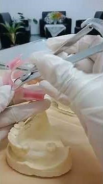 valplast flexible denture