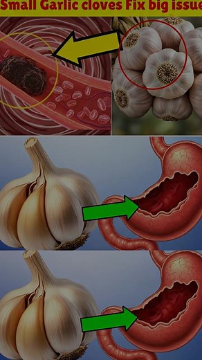 Take Garlic, But Avoid This Common Mistake! | 95% of People Are Unaware Must express something to keep getting my recipes.... Thank you😍 Recipe in (c.o.m.m.e.n.t ).👇 | Clean Life Hacks