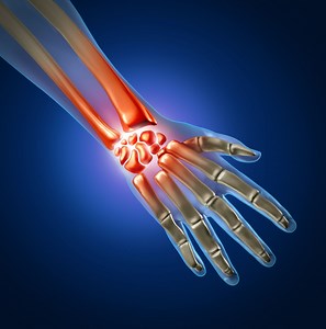 Orthopedic Hand & Wrist Surgery in Plano, Frisco, McKinney and Allen