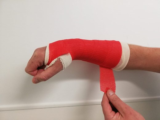 Caring for your plaster cast | Fracture Clinic | Royal Cornwall Hospitals NHS Trust