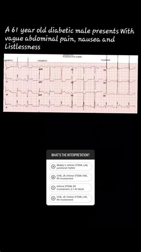 Alireza sadeghi on Instagram: "#ECG #EKG #PARAMEDIC #firefighter #emergencymedicine"