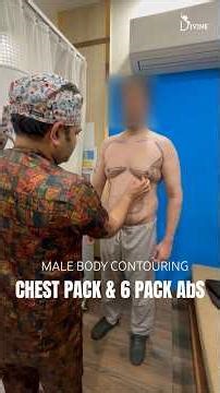 International Patient 3-Month Result | Gynecomastia + Abs Lipo + Back Contouring in India