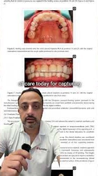 Is Photogrammetry the New Standard for Full-Arch Implant Dentistry? 🦷 I #shorts