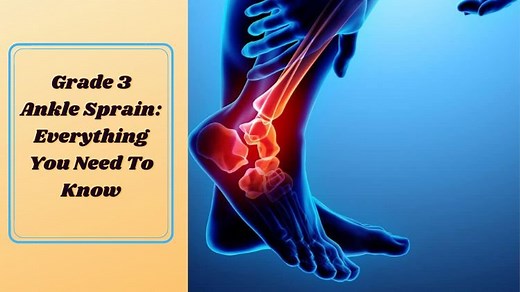 Grade 3 Ankle Sprain: Everything You Need To Know - Dr. Manoj Kumar Khemani