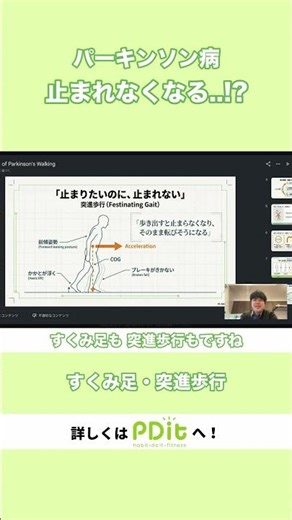 止まりたいのに止まれない…これが原因です【パーキンソン病】
