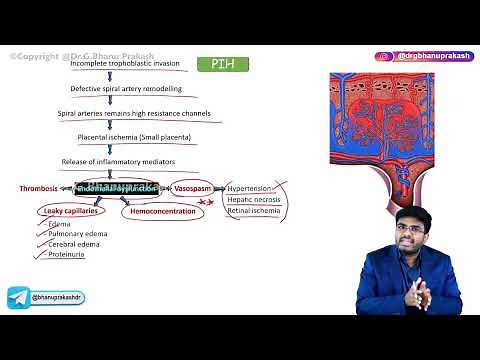 25. Pregnancy Induced Hypertension (Part -2): Obstetrics and Gynecology Lectures