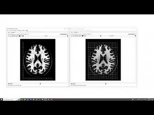 Coordinate system in NIFTI and how to convert them